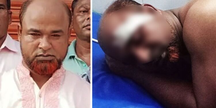 নাগরিক ঐক্যের নেতাকে ছুরিকাঘাত