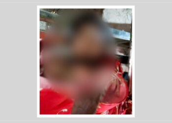 ৯ মাস পর পৃথিবী ছাড়লো গুলিবিদ্ধ কিশোর