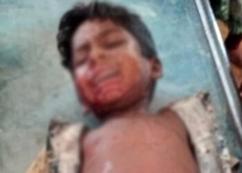 কুড়িয়ে পাওয়া ককটেল বিস্ফোরণে আহত ৩ শিশু