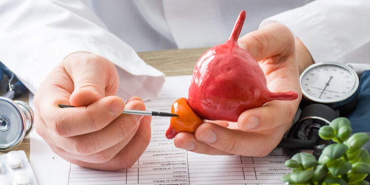 প্রোস্টেট ক্যানসার থেকে বাঁচতে যে খাবার এড়িয়ে চলবেন