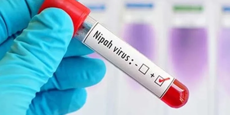 ৩৫ জেলায় শনাক্ত নিপা ভাইরাস